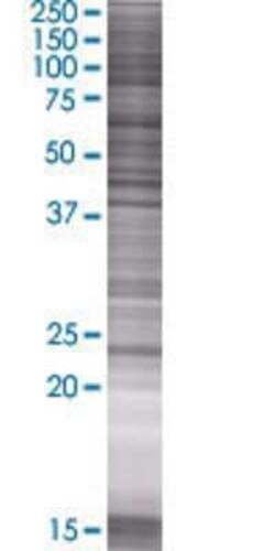 Novus Biologicals Rab11 293T Cell Transient Overexpression Lysate 0.1 mL | Buy Online | Novus Biologicals&trade; | Fisher Scientific