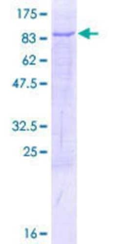 Novus Biologicals Recombinant Human TBRG4 GST (N-Term) Protein 10 &mu;g | Buy Online | Novus Biologicals&trade; | Fisher Scientific