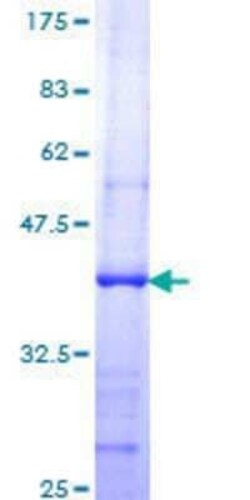 Novus Biologicals Recombinant Human TBRG4 GST (N-Term) Protein 25 &mu;g | Buy Online | Novus Biologicals&trade; | Fisher Scientific