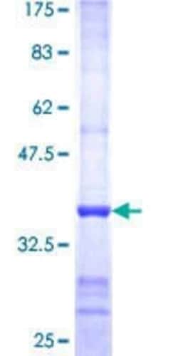 Novus Biologicals Recombinant Human PNMA1 GST (N-Term) Protein 10 &mu;g | Buy Online | Novus Biologicals&trade; | Fisher Scientific