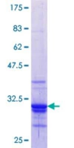 Novus Biologicals Recombinant Human Musculin GST (N-Term) Protein 25 &mu;g | Buy Online | Novus Biologicals&trade; | Fisher Scientific