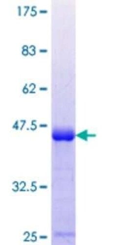 Novus Biologicals Recombinant Human Musculin GST (N-Term) Protein 10 &mu;g | Buy Online | Novus Biologicals&trade; | Fisher Scientific