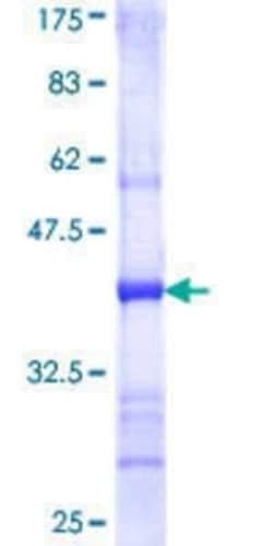 Novus Biologicals Recombinant Human CRLF1 GST (N-Term) Protein 10 &mu;g | Buy Online | Novus Biologicals&trade; | Fisher Scientific