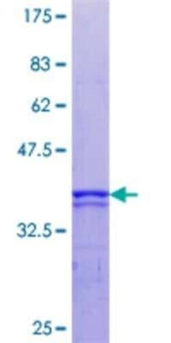 Novus Biologicals Recombinant Human MSK1/RPS6KA5 GST (N-Term) Protein 10 &mu;g | Buy Online | Novus Biologicals&trade; | Fisher Scientific