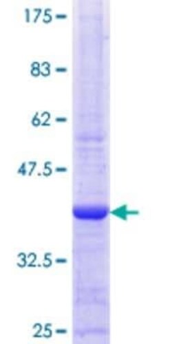 Novus Biologicals Recombinant Human MSK1/RPS6KA5 GST (N-Term) Protein 25 &mu;g | Buy Online | Novus Biologicals&trade; | Fisher Scientific