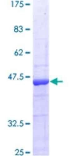 Novus Biologicals Recombinant Human ICAP-1 GST (N-Term) Protein 25 &mu;g | Buy Online | Novus Biologicals&trade; | Fisher Scientific