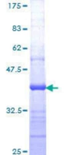 Novus Biologicals Recombinant Human ICAP-1 GST (N-Term) Protein 25 &mu;g | Buy Online | Novus Biologicals&trade; | Fisher Scientific