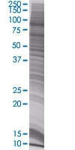 Novus Biologicals PIWIL1/HIWI 293T Cell Transient Overexpression Lysate 0.1 mL | Buy Online | Novus Biologicals&trade; | Fisher Scientific
