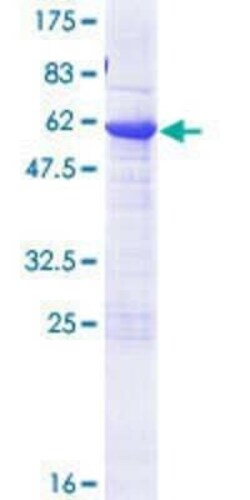 Novus Biologicals Recombinant Human BCL7B GST (N-Term) Protein 25 &mu;g | Buy Online | Novus Biologicals&trade; | Fisher Scientific