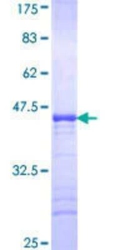 Novus Biologicals Recombinant Human BCL7B GST (N-Term) Protein 10 &mu;g | Buy Online | Novus Biologicals&trade; | Fisher Scientific