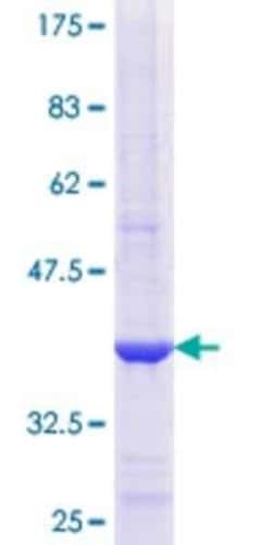 Novus Biologicals Recombinant Human COPB2 GST (N-Term) Protein 25 &mu;g | Buy Online | Novus Biologicals&trade; | Fisher Scientific