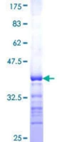 Novus Biologicals Recombinant Human GPR37L1 GST (N-Term) Protein 25 &mu;g | Buy Online | Novus Biologicals&trade; | Fisher Scientific