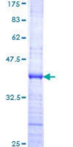 Novus Biologicals Recombinant Human NPIP GST (N-Term) Protein 25 &mu;g | Buy Online | Novus Biologicals&trade; | Fisher Scientific