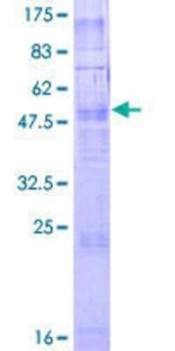 Novus Biologicals Recombinant Human TAAR2 GST (N-Term) Protein 2 &mu;g | Buy Online | Novus Biologicals&trade; | Fisher Scientific