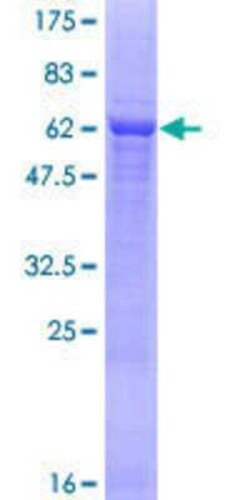Novus Biologicals Recombinant Human PTER GST (N-Term) Protein 25 &mu;g | Buy Online | Novus Biologicals&trade; | Fisher Scientific