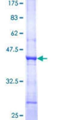 Novus Biologicals Recombinant Human PTER GST (N-Term) Protein 25 &mu;g | Buy Online | Novus Biologicals&trade; | Fisher Scientific