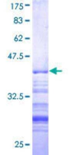 Novus Biologicals Recombinant Human Thyroid receptor-interacting protein 12 GST (N-Term) Protein 10 &mu;g | Buy Online | Novus Biologicals&trade; | Fisher Scientific