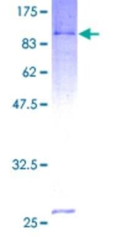 Novus Biologicals Recombinant Human ASC1 GST (N-Term) Protein 25 &mu;g | Buy Online | Novus Biologicals&trade; | Fisher Scientific