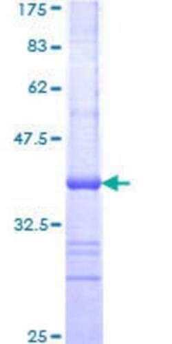 Novus Biologicals Recombinant Human GTF3C4 GST (N-Term) Protein 10 &mu;g | Buy Online | Novus Biologicals&trade; | Fisher Scientific