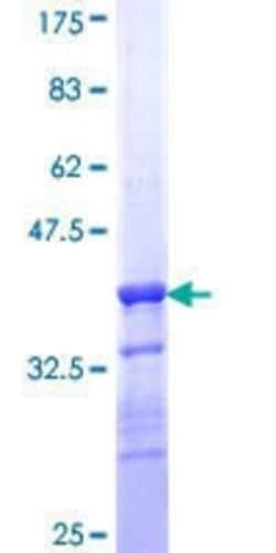 Novus Biologicals Recombinant Human Transglutaminase 5 GST (N-Term) Protein 25 &mu;g | Buy Online | Novus Biologicals&trade; | Fisher Scientific
