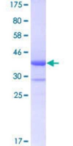 Novus Biologicals&trade;&nbsp;Recombinant Human B4GALT5 GST (N-Term) Protein