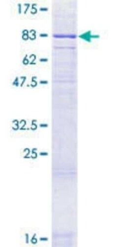 Novus Biologicals Recombinant Human GLP-2R GST (N-Term) Protein 2 &mu;g | Buy Online | Novus Biologicals&trade; | Fisher Scientific