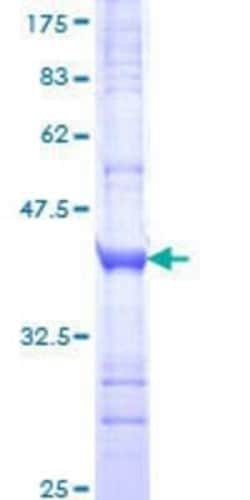 Novus Biologicals Recombinant Human GLP-2R GST (N-Term) Protein 10 &mu;g | Buy Online | Novus Biologicals&trade; | Fisher Scientific