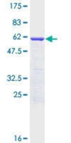 Novus Biologicals Recombinant Human SNAP29 GST (N-Term) Protein 10 &mu;g | Buy Online | Novus Biologicals&trade; | Fisher Scientific