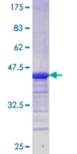 Novus Biologicals Recombinant Human SNAP29 GST (N-Term) Protein 10 &mu;g | Buy Online | Novus Biologicals&trade; | Fisher Scientific
