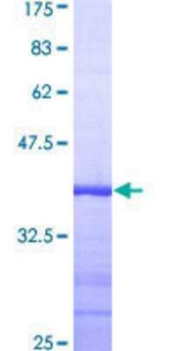 Novus Biologicals Recombinant Human TAO2 GST (N-Term) Protein 10 &mu;g | Buy Online | Novus Biologicals&trade; | Fisher Scientific