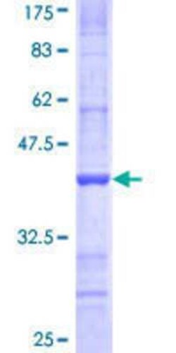 Novus Biologicals Recombinant Human NDST3 GST (N-Term) Protein 2 &mu;g | Buy Online | Novus Biologicals&trade; | Fisher Scientific