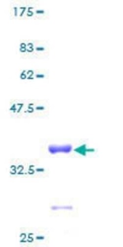 Novus Biologicals Recombinant Human 60S ribosomal protein L23 GST (N-Term) Protein 2 &mu;g | Buy Online | Novus Biologicals&trade; | Fisher Scientific