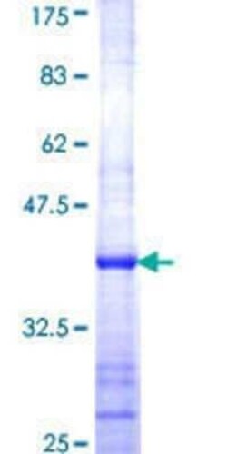 Novus Biologicals Recombinant Human 60S ribosomal protein L23 GST (N-Term) Protein 10 &mu;g | Buy Online | Novus Biologicals&trade; | Fisher Scientific