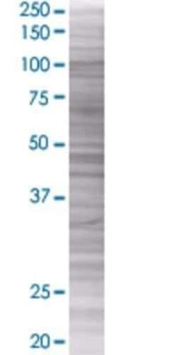 Novus Biologicals Cerberus 1 293T Cell Transient Overexpression Lysate 0.1 mL | Buy Online | Novus Biologicals&trade; | Fisher Scientific