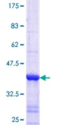 Novus Biologicals Recombinant Human LONP1 GST (N-Term) Protein 10 &mu;g | Buy Online | Novus Biologicals&trade; | Fisher Scientific