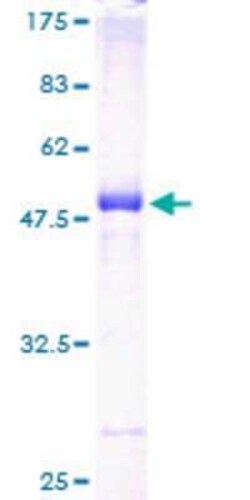 Novus Biologicals Recombinant Human RAB33A GST (N-Term) Protein 25 &mu;g | Buy Online | Novus Biologicals&trade; | Fisher Scientific