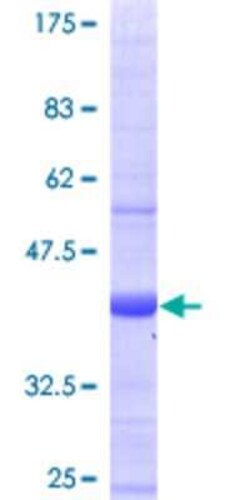 Novus Biologicals Recombinant Human RAB28 GST (N-Term) Protein 25 &mu;g | Buy Online | Novus Biologicals&trade; | Fisher Scientific