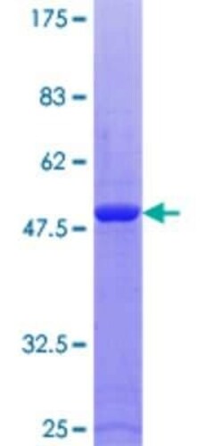 Novus Biologicals Recombinant Human RAB9A GST (N-Term) Protein 25 &mu;g | Buy Online | Novus Biologicals&trade; | Fisher Scientific