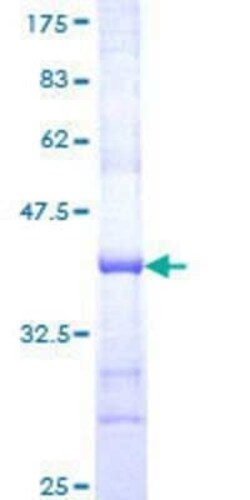 Novus Biologicals Recombinant Human RAB9A GST (N-Term) Protein 10 &mu;g | Buy Online | Novus Biologicals&trade; | Fisher Scientific