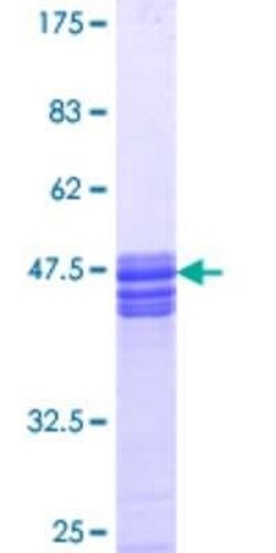 Novus Biologicals Recombinant Human NHERF-1 GST (N-Term) Protein 10 &mu;g | Buy Online | Novus Biologicals&trade; | Fisher Scientific