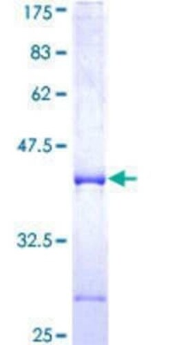 Novus Biologicals Recombinant Human Neurexin 3/NRXN3 GST (N-Term) Protein 10 &mu;g | Buy Online | Novus Biologicals&trade; | Fisher Scientific
