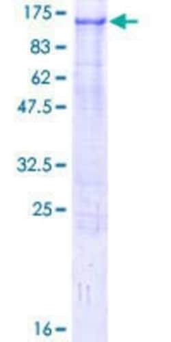 Novus Biologicals Recombinant Human ZFYVE9 GST (N-Term) Protein 25 &mu;g | Buy Online | Novus Biologicals&trade; | Fisher Scientific