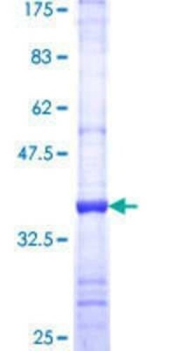 Novus Biologicals Recombinant Human PLAP GST (N-Term) Protein 25 &mu;g | Buy Online | Novus Biologicals&trade; | Fisher Scientific