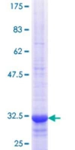 Novus Biologicals Recombinant Human SLC22A8 GST (N-Term) Protein 25 &mu;g | Buy Online | Novus Biologicals&trade; | Fisher Scientific