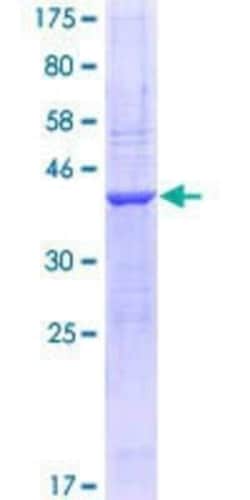 Novus Biologicals Recombinant Human NRXN1 GST (N-Term) Protein 10 &mu;g | Buy Online | Novus Biologicals&trade; | Fisher Scientific