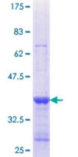 Novus Biologicals Recombinant Human COG1 GST (N-Term) Protein 25 &mu;g | Buy Online | Novus Biologicals&trade; | Fisher Scientific