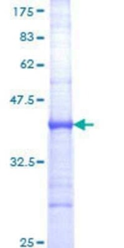 Novus Biologicals Recombinant Human IGSF2/CD101 GST (N-Term) Protein 10 &mu;g | Buy Online | Novus Biologicals&trade; | Fisher Scientific