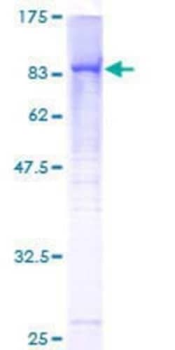 Novus Biologicals Recombinant Human RECQL4 GST (N-Term) Protein 25 &mu;g | Buy Online | Novus Biologicals&trade; | Fisher Scientific
