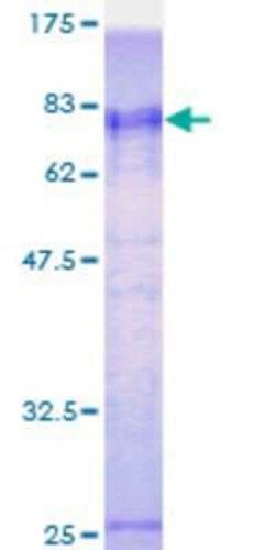 Novus Biologicals Recombinant Human ZRANB2 GST (N-Term) Protein 25 &mu;g | Buy Online | Novus Biologicals&trade; | Fisher Scientific