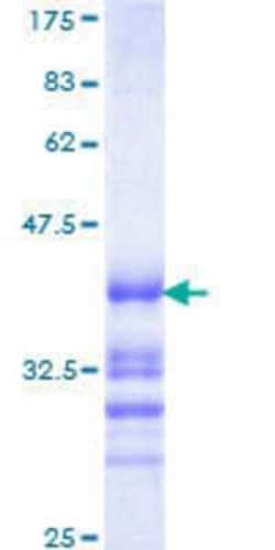 Novus Biologicals Recombinant Human ZRANB2 GST (N-Term) Protein 10 &mu;g | Buy Online | Novus Biologicals&trade; | Fisher Scientific